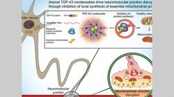 Is ALS reversible? -TAU study