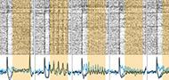 Sleep-like changes in neural processing emerge during sleep deprivation in early auditory cortex